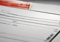 红米10多重？机身尺寸厚度重量参数详解