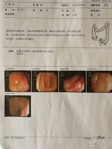 憩肉是什么-图3