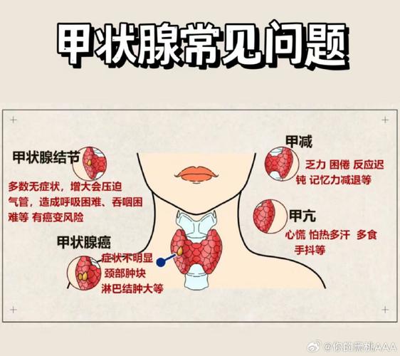 甲泉腺是什么-图2